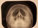 Beatles - Martha My Dear X-RAY SKULL BONES RECORDS USSR 155