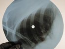 NINA SIMONE LOVE ME OR LEAVE X-Ray USSR Record Roentgen Bones Ribs Music Vinyl