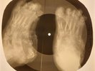 Beatles - Birthday X-RAY FOOTS BONES RECORDS USSR 136