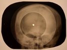 Beatles - Matchbox  X-RAY SKULL BONES RECORDS USSR 124