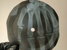 ZOMBIES  SOUTH AFRICA INDIGO X-Ray USSR Record Roentgen Bones RIbs Music Vinyl