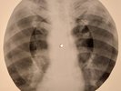 Chuck Berry - My Mustang Ford  X-RAY  BONES RECORDS USSR 166