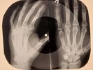 Rolling Stones - Stoned  X-RAY HANDS BONES RECORDS USSR 150