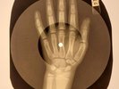 Elvis Presley - Just Because  X-RAY HAND BONES RECORDS USSR 148