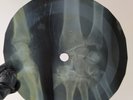 JAMES RAY A MIRACLE X-Ray USSR Record Roentgen Bones RIBS Music Vinyl