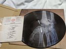 KASABIAN LP THE ALCHEMIST’S EUPHORIA X-RAY PICTURE DISC 1736/2000 IN HAND