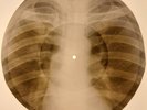 Beatles - Get Back  X-RAY BONES RECORDS USSR 187