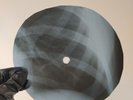 LOS BRAVOS BLACK IS BLACK Ray USSR Record Roentgen Bones Ribs Music Vinyl