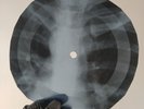 BEATLES SOMETHING Ray USSR Record Roentgen Bones Ribs Music Vinyl