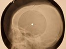 David Bowie - Conversational Piece X-RAY SKULL BONES RECORDS USSR 173