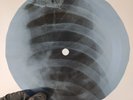 BEATLES ELEANOR RIGBY X-Ray USSR Record Roentgen Bones Ribs Music Vinyl