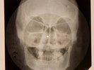 Elvis Presley - In The Ghetto X-RAY SKULL BONES RECORDS USSR 203