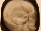 Beatles - Nowhere Man  X-RAY SKULL BONES RECORDS USSR 178