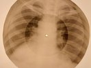 Elvis Presley - Like A Baby X-RAY BONES RECORDS USSR 201