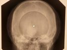 Ricky Nelson - Teenage Idol X-RAY SKULL BONES RECORDS USSR 182