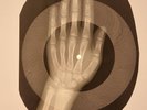 Beatles - Little Child X-RAY HAND BONES RECORDS USSR 190