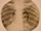 Elvis Presley - Can't Help Falling In Love X-RAY BONES RECORDS USSR 256