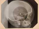 Beatles - Girl X-RAY SKULL EARRING BONES RECORDS USSR 263