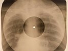 Bob Dylan - Ballad Of A Thin Man X-RAY BONES RECORDS USSR 262