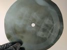 ROLLING STONES EMPTY HEART X-Ray USSR Record Roentgen Bones Ribs Music Vinyl