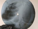 BEATLES CANT BUY ME LOVE X-Ray USSR Record Roentgen Bones Ribs Music Vinyl