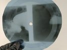 BEATLES IF I FELL X-Ray USSR Record Roentgen Bones Ribs Music Vinyl