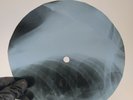 SMOKEY ROBINSON TRACKS OF TEAR X-Ray USSR Record Roentgen Bones Ribs Music Vinyl