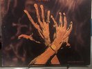 ed watson hot soca vinyl Lp Album Record 1980 Circle Records Calypso US Import