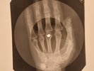 Who - I'm Free X-RAY HAND BONES RECORDS USSR 234