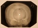Rolling Stones - Route 66  X-RAY SKULL BONES RECORDS USSR 175