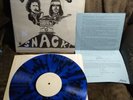 BOB DYLAN & NEIL YOUNG SNACK  LP ROCK N ROLL VIBRATOR BLUE SPLATTER WHITE LABEL