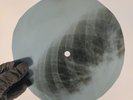 BLACK SABBATH SLEEPING VILLAGE X-Ray USSR Record Roentgen Bones Ribs Music Vinyl
