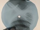 CILLA BLACK SURROUND YOURSELF  X-Ray USSR Record Roentgen Bones Ribs Music Vinyl