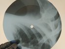 DAVID BOWIE BLACK COUNTRY ROCK X-Ray USSR Record Roentgen Bones Ribs Music Vinyl