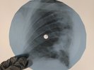 ROLLING STONES STREET FIGHTING X-Ray USSR Record Roentgen Bones Ribs Music Vinyl