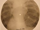 Ronettes - Walking In The Rain X-RAY BONES RECORDS USSR 247