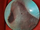 Pink Floyd Meddle harvest shvl 795