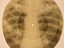Elvis Presley - Loving You  X-RAY BONES RECORDS USSR 323