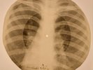Beatles - Rock & Roll Music X-RAY BONES RECORDS USSR 303