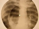 Bob Dylan - Blowin' In The Wind X-RAY BONES RECORDS USSR 313