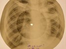 Elvis Presley - Blueberry Hill X-RAY BONES RECORDS USSR 304