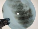 LITTLE RICHARD READY TEDDY X-Ray USSR Record Roentgen Bones Ribs Music Vinyl