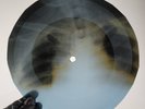 PIMK FLOYD SUMMER 68 X-Ray USSR Record Roentgen Bones Ribs Music Vinyl