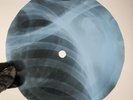 BEATLES CHAINS X-Ray USSR Record Roentgen Bones Ribs Music Vinyl