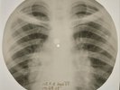 Johnny Cash - Ballad Of A Teen X-RAY BONES RECORDS USSR 338