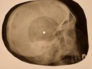 Rolling Stones - Rip This Joint X-RAY SKULL BONES RECORDS USSR 170