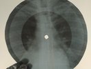 STOOGES NO FUN X-Ray USSR Record Roentgen Bones Ribs Music Vinyl