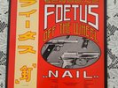 SCRAPING THE FOETUS OFF THE WHEEL NAIL 12