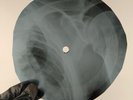 PINK FLOYD MOTILDA MOTHER X-Ray USSR Record Roentgen Bones Ribs Music Vinyl