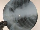 NINA SIMONE SINNERMAN X-Ray USSR Record Roentgen Bones Ribs Music Vinyl